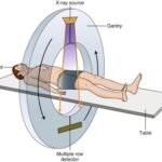 Teknologi Cone Beam CT